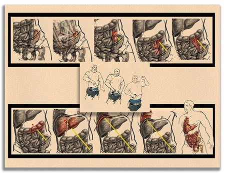 Forensic pathology examination of skeletal evidence in laboratory