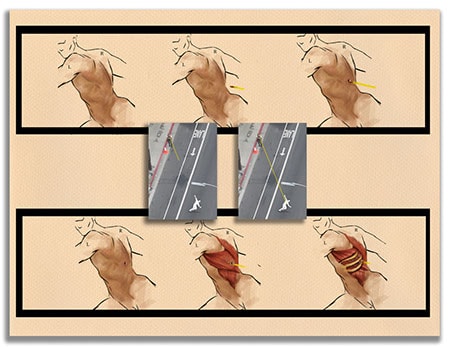 Anatomical diagram used as courtroom demonstrative exhibit
