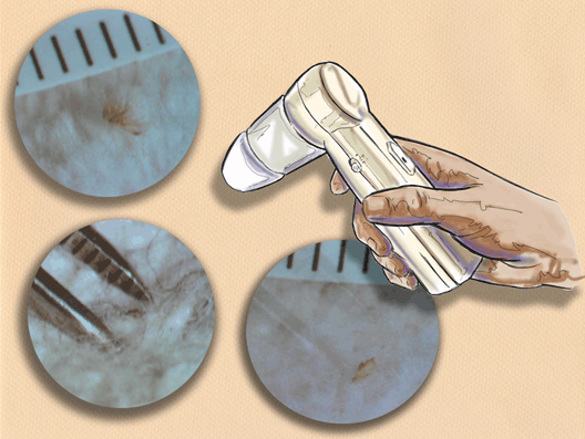 Blood and Trace Evidence Detection